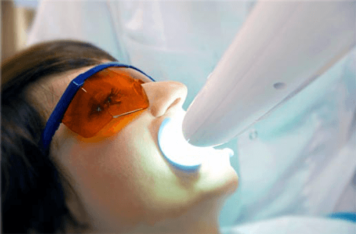 Understanding the Causes of Teeth Sensitivity Stafford