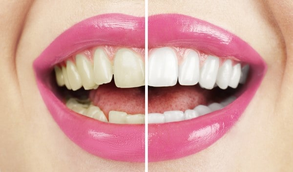 What Early Signs of Oral Cancer Should You Never Ignore Stafford?