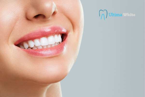Common Mistakes That Can Ruin Your Whitening Results Stafford