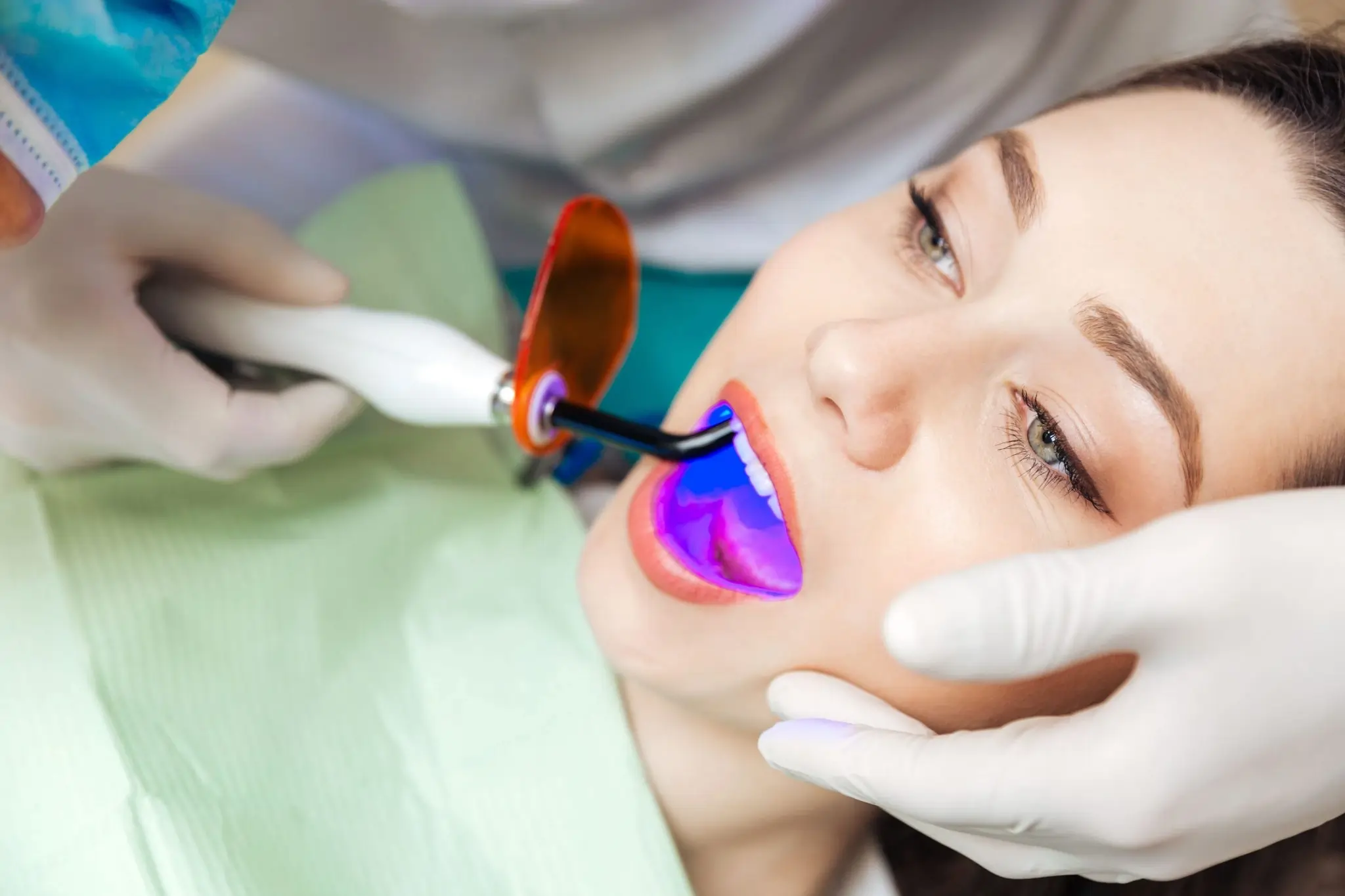 What Exactly Is Laser Teeth Whitening and How Does It Work Stafford?