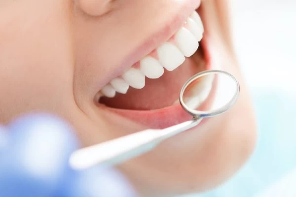 How Much Fluoride Do You Really Need Stafford?
