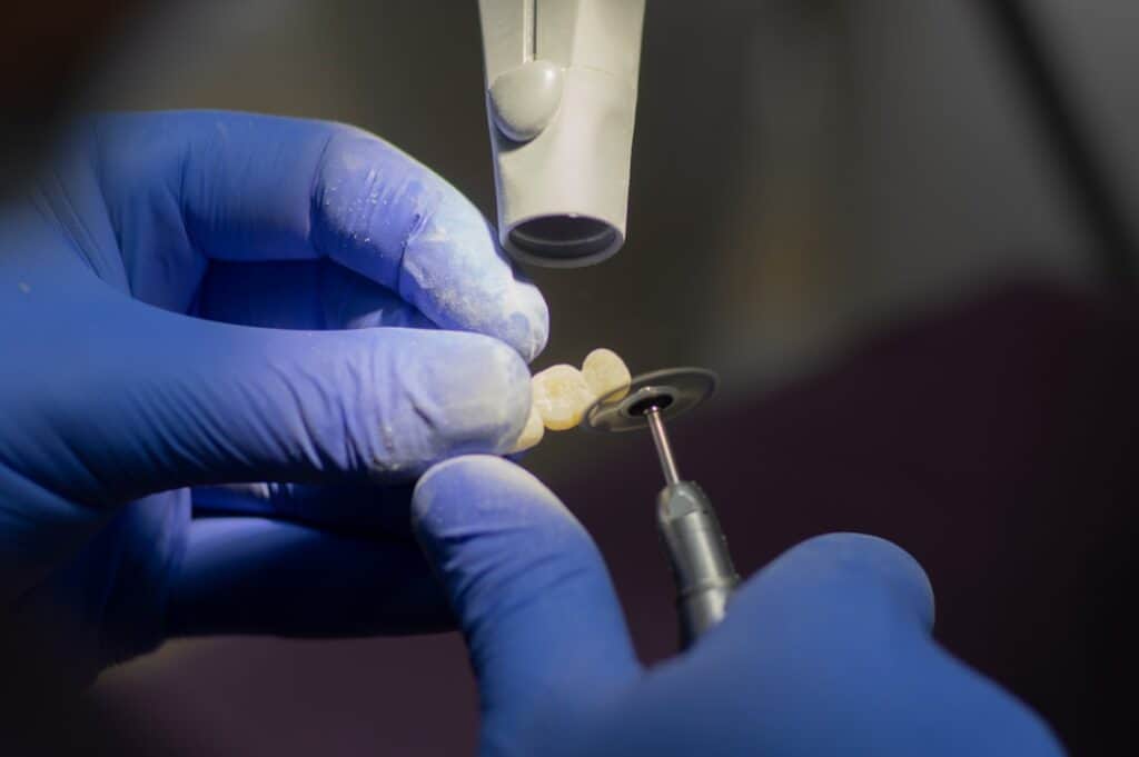 Customised Dental Solutions: Crowns, Aligners, and Implants Stafford