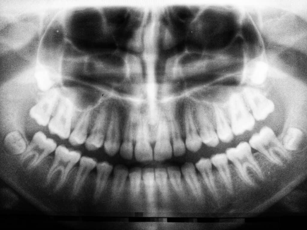 The Future of 3D Printing in Oral Healthcare Stafford